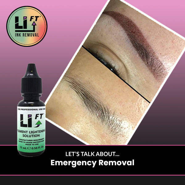 Let's talk about... Emergency Removal®!